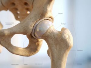 Gezonde heupgewricht anatomie met gladde kraakbeen oppervlakken en sterke botstructuur in medische detailweergave