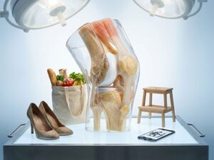 Dwarsdoorsnede van menselijke knie met botten, kraakbeen en pezen, omringd door hakken, tassen en trap