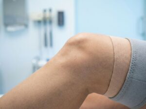 Gezonde menselijke knie in profiel met anatomische details, ondersteunende tape en medische achtergrond