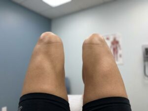 Gezonde knieën in atletische positie met sterke spieren en gewrichtsstabiliteit tegen medische achtergrond