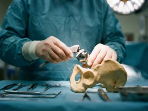 Chirurg positioneert titanium heupprothese boven anatomisch botmodel op steriele operatietafel met instrumenten