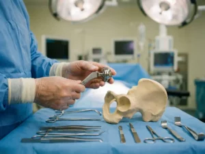 Chirurg positioneert titanium heupprothese boven anatomisch botmodel in steriele operatiekamer