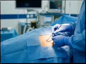 Chirurg voert minimaal invasieve heupvervanging uit met precisie-instrumenten onder operatiekamerverlichting