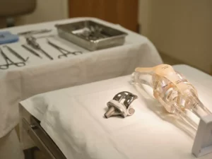 Knieprothese component naast anatomisch kniegewricht model op medische onderzoekstafel met steriele instrumenten