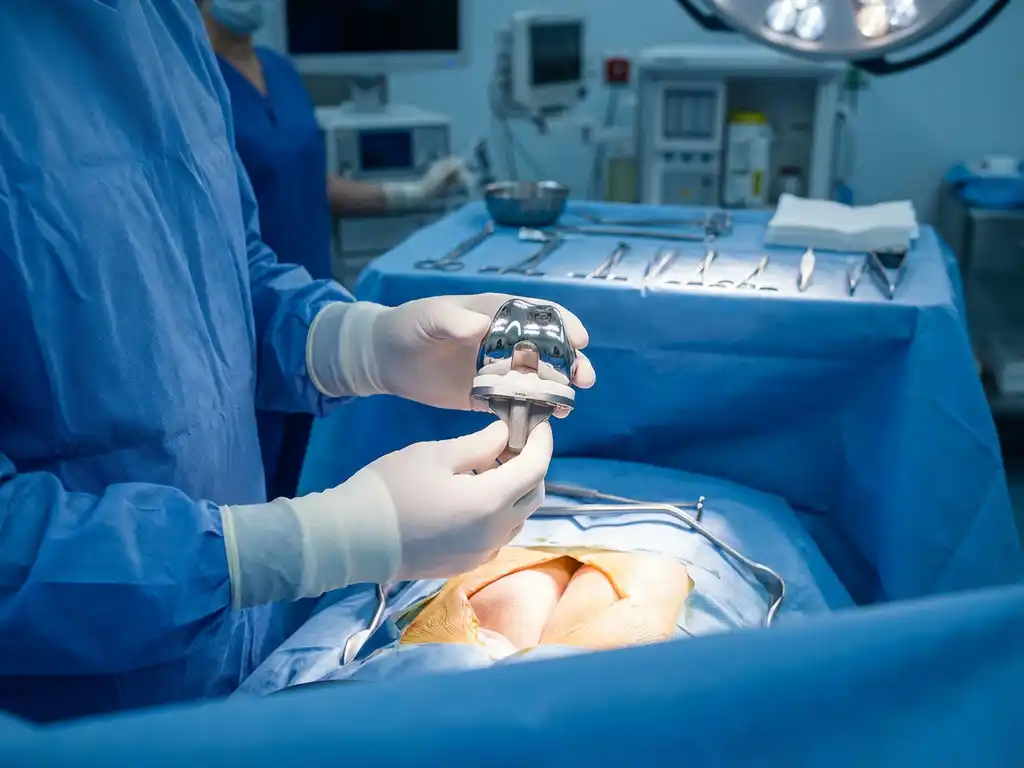 Chirurg houdt titanium knieprothese boven steriel operatieveld in verlichte operatiekamer met medische instrumenten